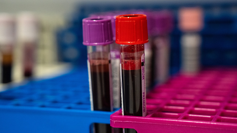 Blood samples in test tubes