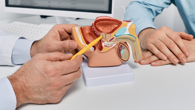 Doctor using prostate model to explain stage 1 prostate cancer to patient